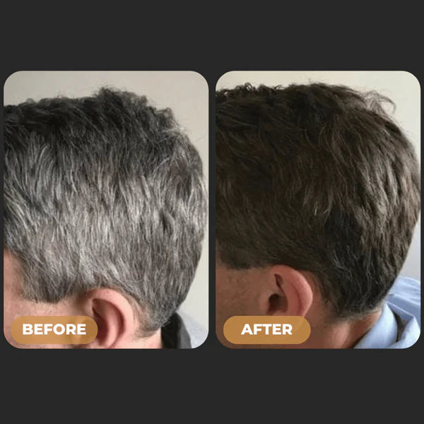 Glamvora™ Gray Hair Reversal Bar