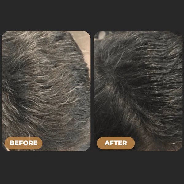 Glamvora™ Gray Hair Reversal Bar