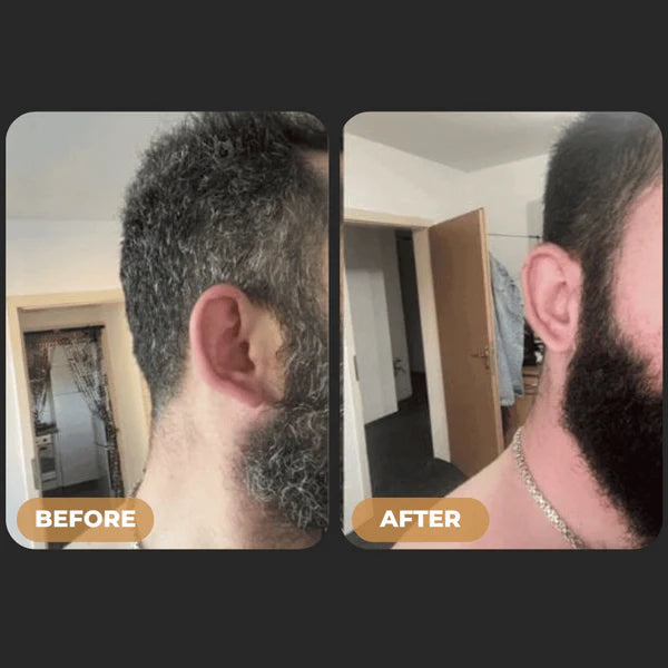 Glamvora™ Gray Hair Reversal Bar